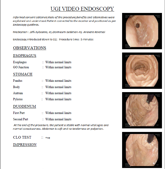 Endoscopy Report Template Fill Online Printable Filla vrogue.co